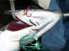 9.2.08_chin_hooked.jpg (81123 bytes)